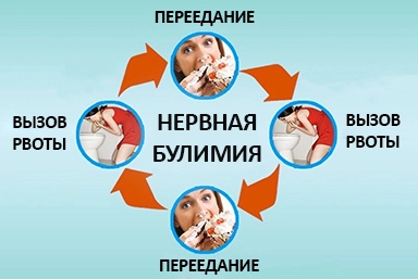 Лечение булимии в Лучегорске